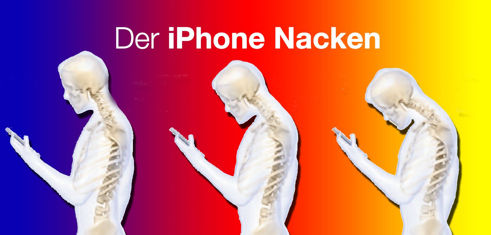 Ärzte warnen vor iPhone Nacken! 1